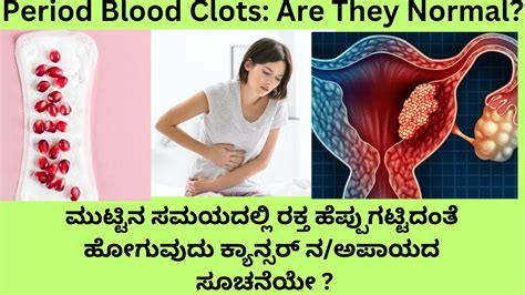 clotsity|Menstrual Clots: Causes, Diagnosis, Treatment & More .